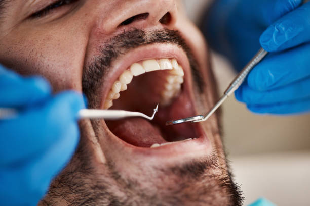 Best Urgent Care for Lost Fillings or Crowns in Tyler, MN
